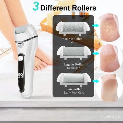 SmoothStep™ Electric Callus Remover™