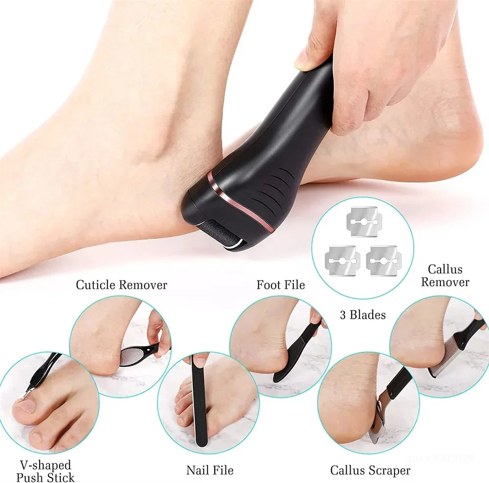 SmoothStep™ Electric Callus Remover™